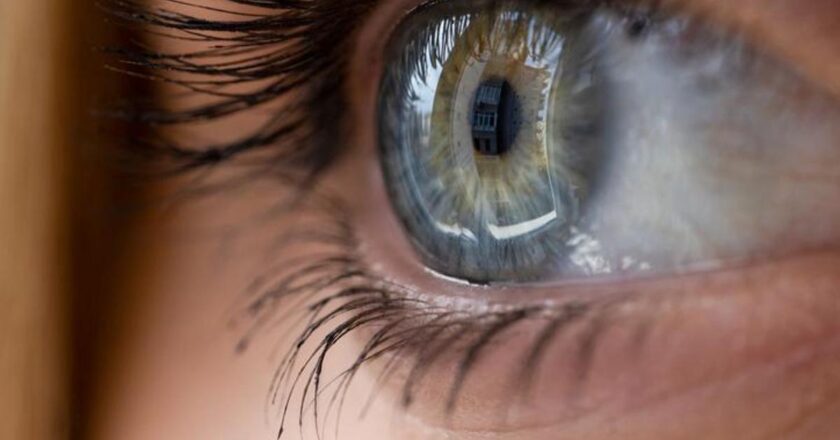 Katarakt Belirtileri Nelerdir? Katarakt Nasıl Anlaşılır? Tedavi Yöntemleri Nelerdir?